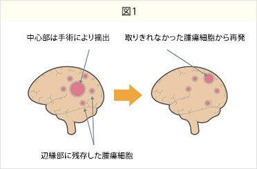 図